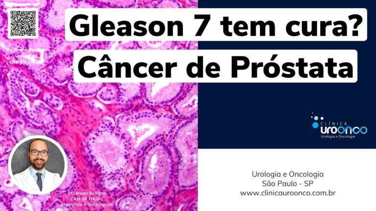 Tratamento otimizado para adenocarcinoma de próstata Gleason 7 3 4