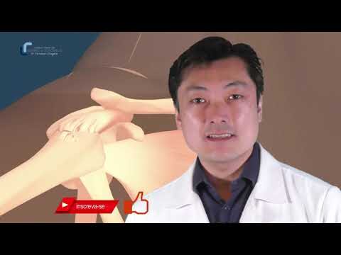 Tratamento eficaz para bursite e tendinite no ombro