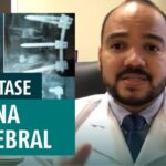 Colocar gelo na coluna cervical: é seguro?