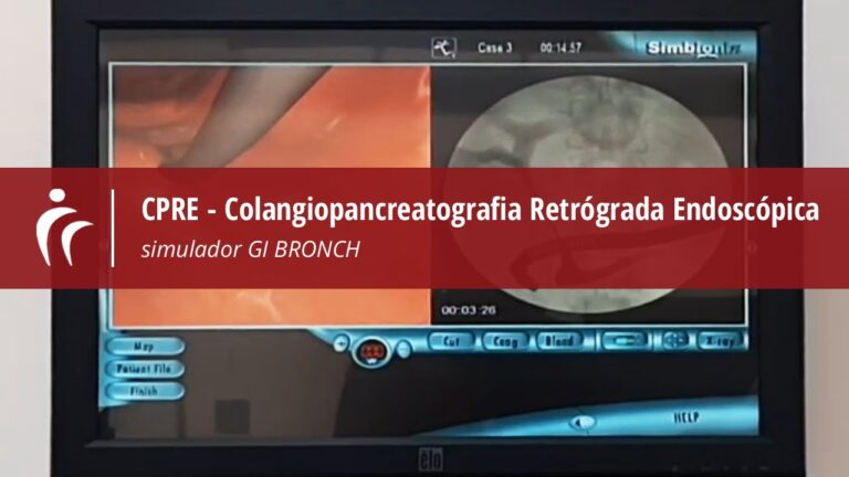 A import&acirc;ncia da colangiopancreatografia retr&oacute;grada endosc&oacute;pica: valor diagn&oacute;stico e terap&ecirc;utico