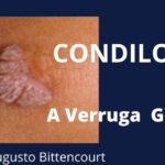 Entenda sobre veia grossa na perna