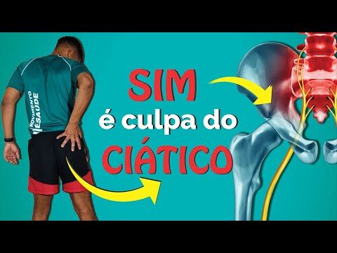 7 maneiras de aliviar a dor no nervo ciático
