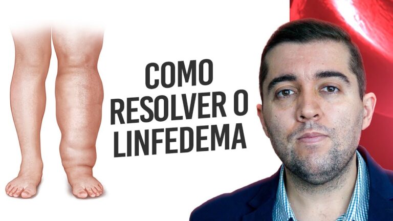 Otimizando o Sistema Linfático das Pernas: Guia Completo