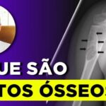 Entenda os Complexos Ventriculares Prematuros