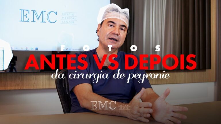Peyronie: Conhe&ccedil;a os Sintomas e Tratamentos – Foto Inclusa