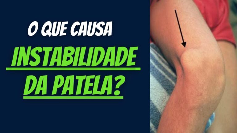 Luxação patelar: causas, sintomas e tratamentos