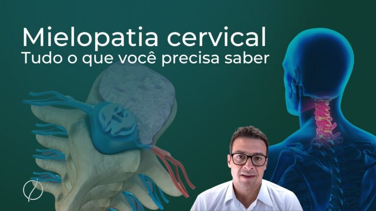 Sintomas de mielopatia cervical: o que saber