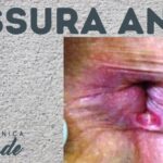Doen&ccedil;as Genitais Femininas: Guia Completo e Atualizado