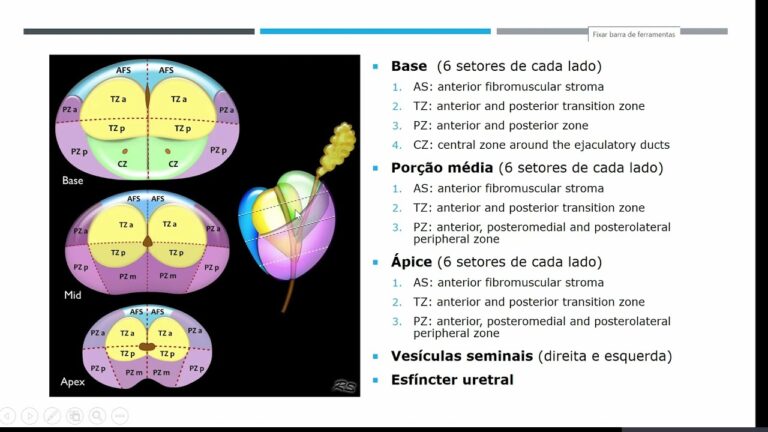 Zona Periférica da Próstata: Heterogeneidade e Implicações