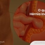 Adenomiose: Entenda o Sangramento Intenso
