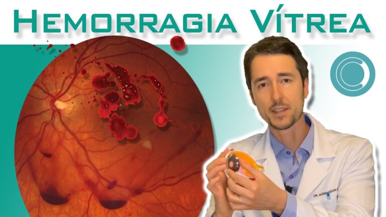 Sangramento na Retina: Causas e Tratamentos