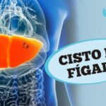 Doen&ccedil;as Genitais Femininas: Guia Completo e Atualizado