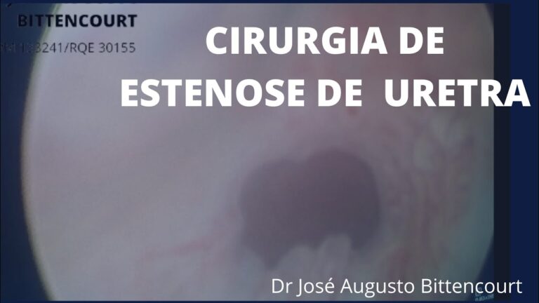Cirurgia Uretral Masculina: Guia Completo