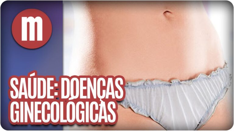 Guia Completo sobre Doen&ccedil;as Ginecol&oacute;gicas: Sintomas, Tratamentos e Preven&ccedil;&atilde;o