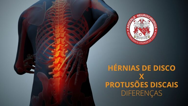 Pequenas Protusões Discais C5-C7: Causas, Sintomas e Tratamentos