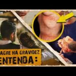 Chás para saúde dos rins e vias urinárias