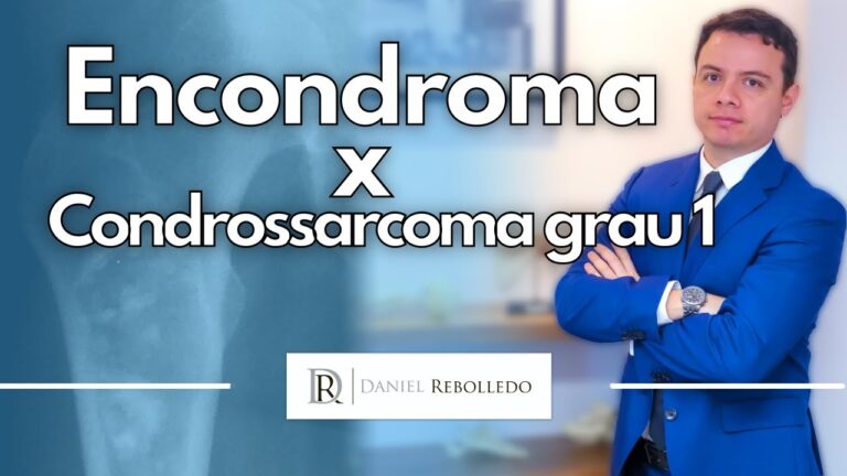 Encondroma: Entenda o que é e como é tratado