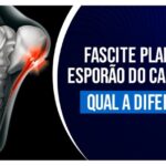 Pitiríase no Couro Cabeludo: Causas, Sintomas e Tratamentos