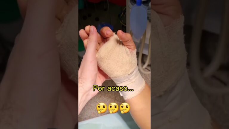 Duração da cirurgia de túnel do carpo: o que esperar