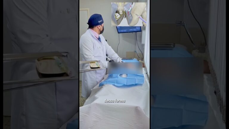 Melhores remédios para dor no nervo pudendo