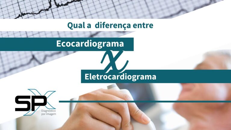 Eletrocardiograma vs Ecocardiograma: Entenda as Diferenças ...