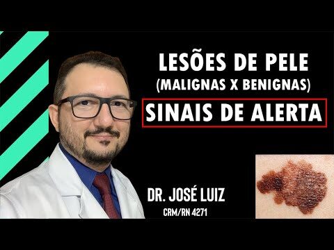 Fotos de Les&otilde;es de Pele Benignas: Guia Visual Completo