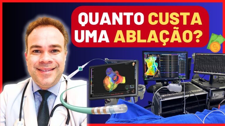 Valor da Cirurgia de Ablação: O que Você Precisa Saber