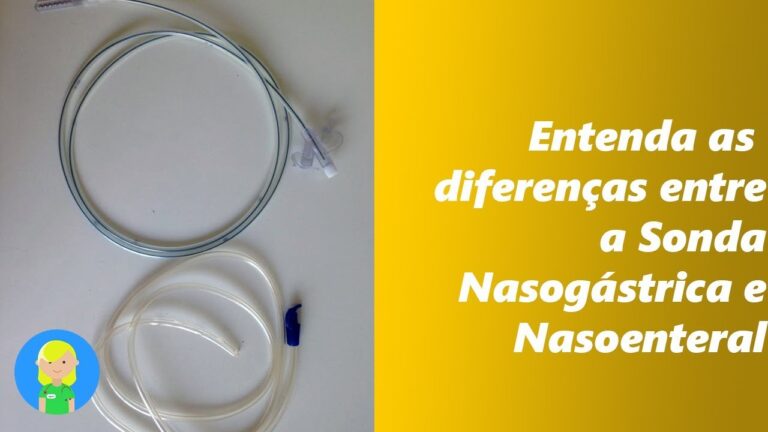 Sonda Nasog&aacute;strica N&deg;4: Guia Completo e Pr&aacute;tico