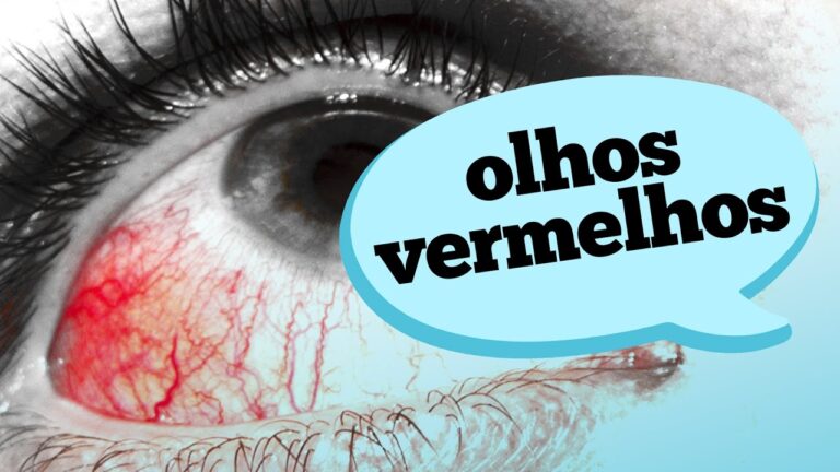 Como tratar a vermelhidão no olho: guia completo | Actualizado abril 2026