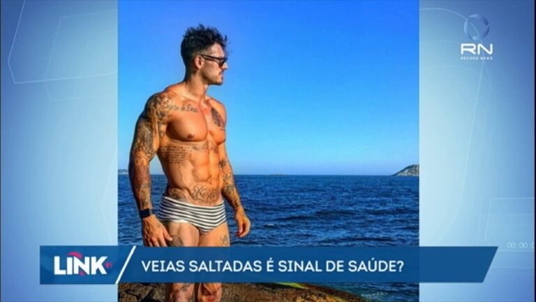 Veias aparentes: causas e soluções