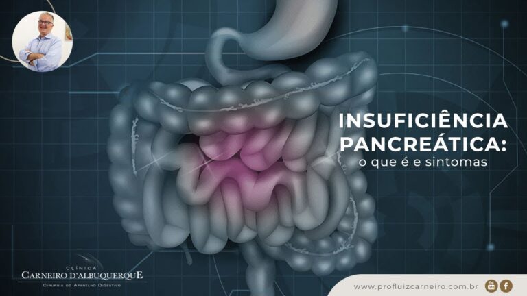 Tratamento da Insuficiência Pancreática: Mitos e Verdades