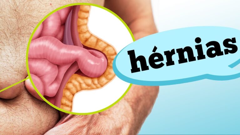 Qual especialista trata hérnias?