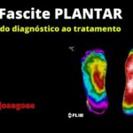 Como Prevenir a Inflamação no Implante: Dicas e Cuidados