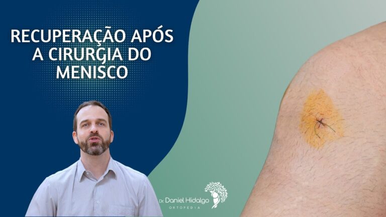 Tempo de recuperação da lesão no menisco: Guia otimizado