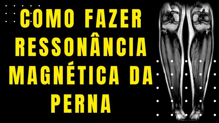 Benefícios da Ressonância Magnética na Perna