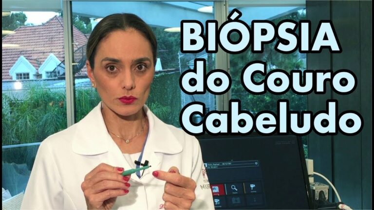 Cuidados pós-biópsia do couro cabeludo: o que você precisa saber