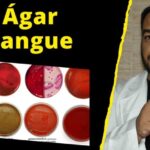 Conheça as Causas e Tratamentos do DST Sangue no Sêmen