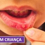 Anatomia e Fun&ccedil;&otilde;es do Osso P&eacute;lvico no Corpo Humano