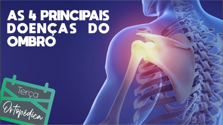 Principais Doenças no Ombro: Diagnóstico e Tratamento