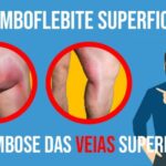 Significado e Import&acirc;ncia do MSS