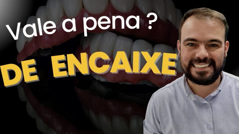 Guia Completo sobre Prótese de Encaixe