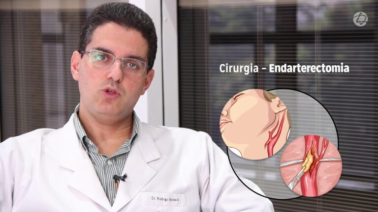 Função e Importância dos Bulbos Carotídeos na Regulação Cardiovascular