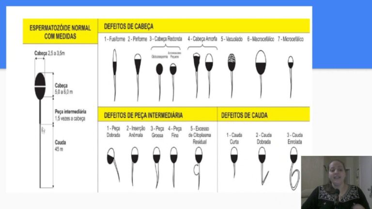 Anomalias de Cabeça no Espermograma: Uma Análise Concisa