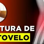 Entenda sobre veia grossa na perna