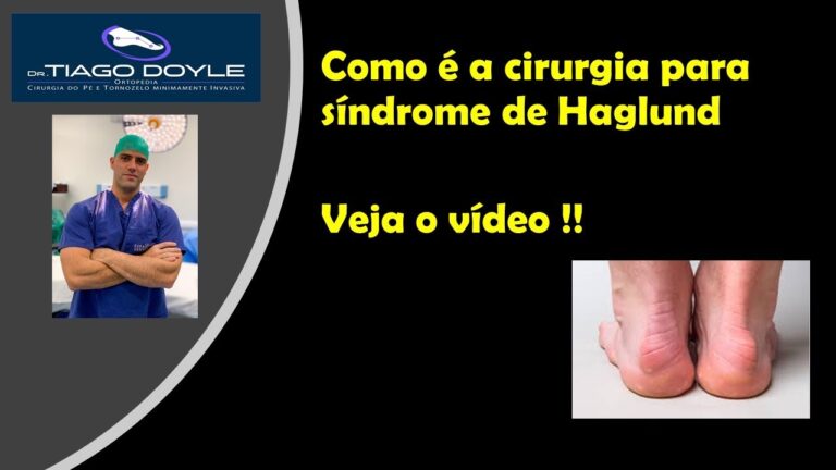 Custo da cirurgia para Síndrome de Haglund: O que esperar