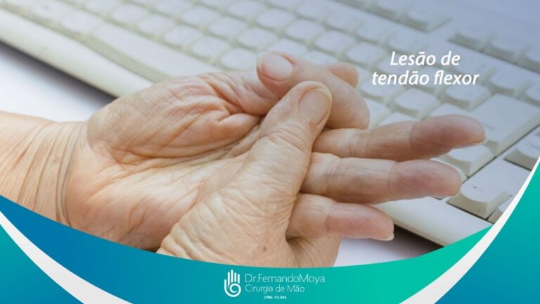 Tendão do Dedo: Funções, Lesões e Tratamentos