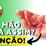 Como Prevenir a Inflamação no Implante: Dicas e Cuidados