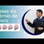 Dose ideal de metotrexato para artrite reumatoide: um guia abrangente