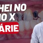 Cirurgia de Hernia Inguinal por Vídeo: Uma Abordagem Otimizada.