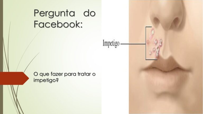 Tratamento Caseiro para Impetigo: Guia Completo